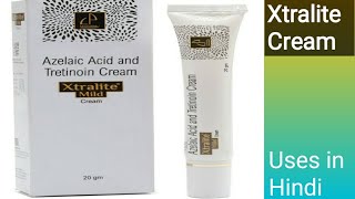 Xtralite mild cream Azelaic acid and Tretinoin cream uses in Hindi [upl. by Deanna]