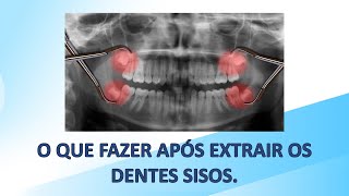 O que fazer após extrair os dentes sisos [upl. by Riay621]