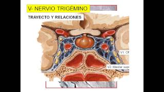 Trigémino pptx [upl. by Dagley]