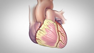 Coronary Artery Bypass Surgery [upl. by Jerol]