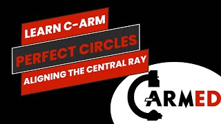 Perfect circles Alignment for IM nailing [upl. by Chaffinch]