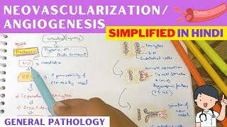 AngiogenesisNeovascularization  Pathology  Hindi [upl. by Gabi]