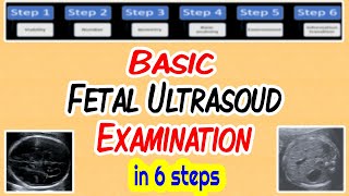 Basic Fetal Ultrasound Examination [upl. by Chrystal506]