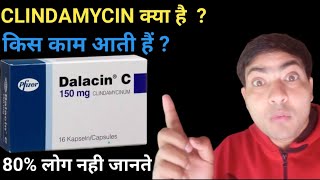 dalacin c 150 mg capsule use in hindi clindamycin capsule [upl. by Akyre]