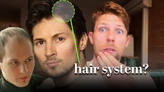 Super Famous Billionaire Is Wearing a HAIR SYSTEM [upl. by Hirz511]