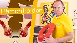 Hämorrhoiden ⚡️ Erkennen Behandeln amp Hilfsmittel [upl. by Petromilli]