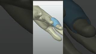 QUICKSURFACEs Medical Uses cad 3dreverseengineering [upl. by Neesay]