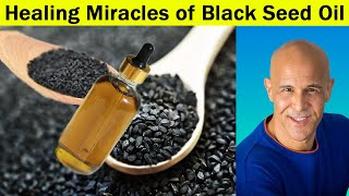 Healing Miracles of Black Seed Oil with Dr Mandell Live Chat Stream [upl. by Marguerite952]