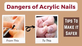 Dangers and Health Risks of Acrylic Nails [upl. by Ilysa569]