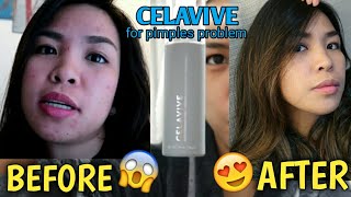 My first Skincare Routine using USANA Celavive for 60days Goodbye AcnePimples [upl. by Odrautse555]