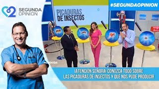 ¿Cómo actuar frente a las picaduras de insectos [upl. by Barra334]