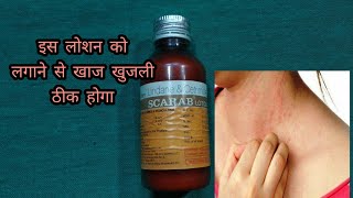 Scarab lotion  lindane and certified lotion  खाज खुलजी के दवा [upl. by Eimmis]