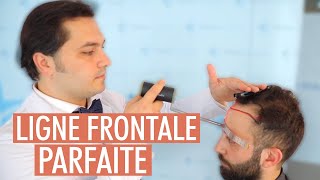 Le Dr Balwi vous informe  la ligne frontale parfaite [upl. by Rivalee]