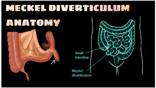 MECKEL DIVERTICULUM Anatomy brdmedicalcollege anatomy mbbs trending youtube top [upl. by Raman153]