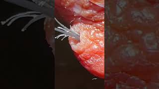 Top 3 Compilation Ingrown hair removal [upl. by Puna]