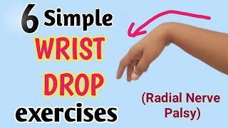 wrist drop exercises in hindi  radial nerve palsy exercises [upl. by Nerot228]