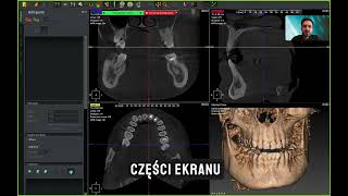 CBCT krok po kroku  od endodoncji po implanty  szkolenie Akademii 3Z [upl. by Lundgren]