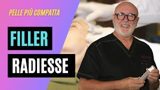 FILLER RADIESSE VISO DOTT PIERCARLO MASOLINI ALESSANDRIA [upl. by Bonneau]