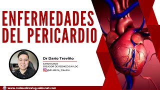 Enfermedades del pericardio ENARM  🩺Dr Treviño [upl. by Ettennahs]