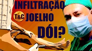 INFILTRAÇÃO NO JOELHO DÓI [upl. by Publius]