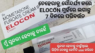 ମୁଁ ସୁନ୍ଦରୀ ହେବାକୁ ଚାହେଁ  Elocon  Mometasone Furoate Cream  ଚେହେରା ସୌନ୍ଦର୍ଯ୍ୟ ବଢ଼ାନ୍ତୁ 7ଦିନରେ [upl. by Kealey]