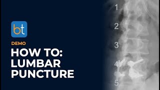 How To Do A Lumbar Puncture Procedure  BackTable Demo [upl. by Jayne628]