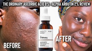 THE ORDINARY ASCORBIC ACID 8  ALPHA ARBUTIN 2 VITAMIN C SERUM INDEPTH REVIEW [upl. by Debbra]