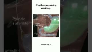 Vomiting  What happens during vomiting  Esophagus  Pyloric Sphincter  food [upl. by Natalia]