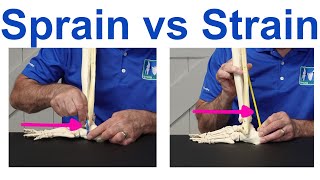 Sprain vs Strain Understanding the Key Differences [upl. by Kannav799]