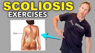 5 Scoliosis Rehab Exercises [upl. by Morry925]