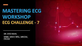 ECG CHALLENGE  7 [upl. by Vijar]