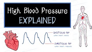 What is High Blood Pressure HealthSketch [upl. by Lonnie766]