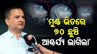 Bolangir Black Magic Case Removing 70 Needles from Head Is First Incident in My Career Says Doctor [upl. by Marybella]