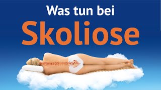 Skoliose [upl. by Eened]