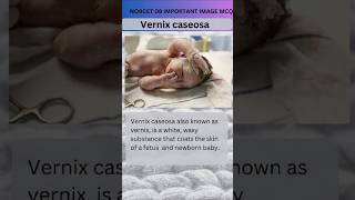 Vernix caseosa Norcet 08 important image Base mcq  Maternity nursingytviralshort [upl. by Wilmott]