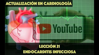 21 ENDOCARDITIS INFECCIOSA [upl. by Luehrmann]