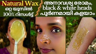 Natural Hair Removal Wax❤Remove unwanted hair black amp white heads easily❤Wax body hair ampunderarms [upl. by Gnet249]