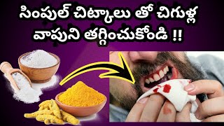 Home Remedies for Bleeding Gums in Teluguచిగుళ్ల నుంచి రక్తం రావడం తగ్గించు కోవడానికి ఇంటి చిట్కాలు [upl. by Aracahs]