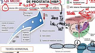 Urología  3 RM19 2V UROLOGIA HIPERPLASIA BENIGNA DE PROSTATA de Qx Medic on Vimeo [upl. by Lajes]