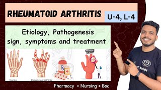 rheumatoid arthritis  rheumatoid arthritis pathophysiology  rheumatoid arthritis nursing sgsir [upl. by Eilime]