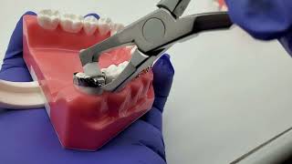 How to remove the molar bands of your braces [upl. by Noseaj]