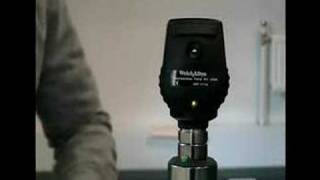 Fundoscopy 2  Equipment  Ophthalmoscope [upl. by Farrah420]