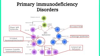 Pathology 40 Primary Immunodeficiency Disorders Xanuunada hoos u dhiga difaaca jidhka [upl. by Ainotna899]