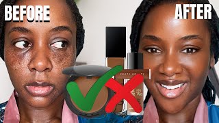 How to Cover Hyperpigmentation with Makeup on Dark Skin INSTANTLY [upl. by Amein]