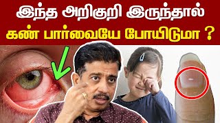 இந்த அறிகுறி இருந்தால் கண் பார்வையே போய்டுமா   Dr Gopinath Interview about Diabetic Retinopathy [upl. by Halludba250]