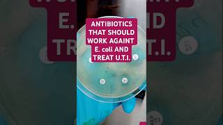 The antibiotics are AMIKACINAK MEROPENEMMEM CIPROFLOXACINCIP TAZOBACTAMTZP AND GENTAMICINCN [upl. by Scoles41]