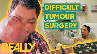 Doctors Remove 3Kg Tumour From A Mans Face  Body Bizarre [upl. by Darla]