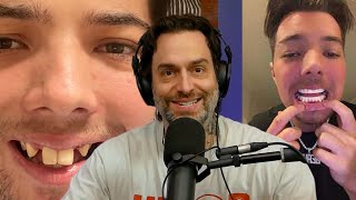 Chris DElia Reacts to Beavos New Teeth [upl. by Llerryt]