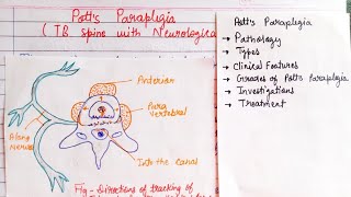 Potts Paraplegia Part1  TB spine with Neurological involvement [upl. by Akayas]