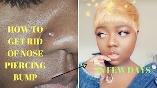 HOW TO GET RID OF NOSE PIERCING BUMP  SUPER FAST AND EASY IN LESS THAN A WEEK [upl. by Wolliw]